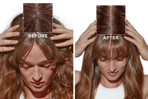 Tester: Symbiose Anti-Pelliculaire Serum - Kérastase | L'Oréal Partner Shop