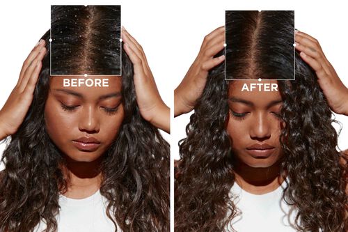 Symbiose Bain Purette - Backbar | L'Oréal Partner Shop