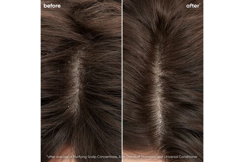 Scalp Sync Purifying Scalp Concentrate - NZ Matrix Treatment Offer | L'Oréal Partner Shop