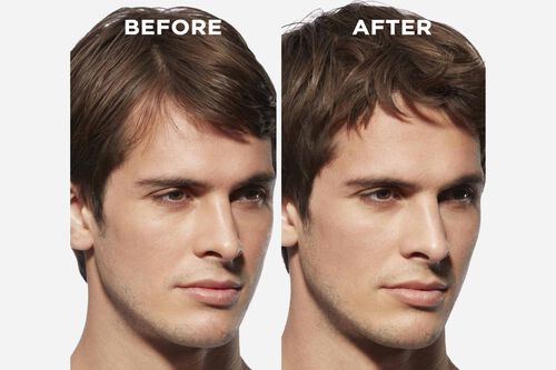 Genesis Homme S&eacute;rum Anti-Chute Fortifiant - Retail Products | L'Or&eacute;al Partner Shop