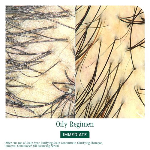 Scalp Sync Oil Balancing Serum - Biolage Renovation NZ | L'Or&eacute;al Partner Shop