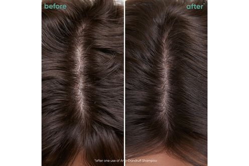 Scalp Sync Universal Conditioner - NZ Matrix Treatment Offer Scalp Sync Universal Conditioner - NZ Matrix Treatment Offer | L'Oréal Partner Shop