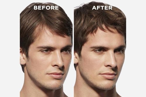 Genesis Homme Bain de Masse &Eacute;paississant - Backbar | L'Or&eacute;al Partner Shop