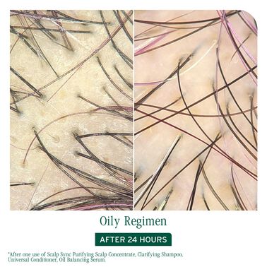 Scalp Sync Oil Balancing Serum - Biolage Renovation NZ | L'Oréal Partner Shop