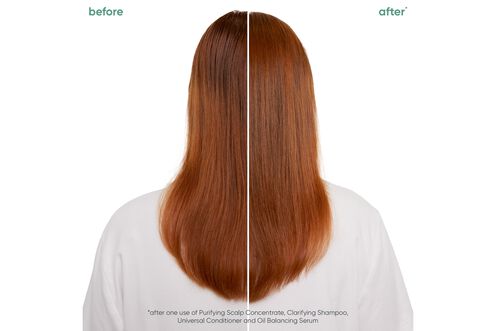 Scalp Sync Oil Balancing Serum - NZ Matrix Treatment Offer Scalp Sync Oil Balancing Serum - NZ Matrix Treatment Offer | L'Oréal Partner Shop